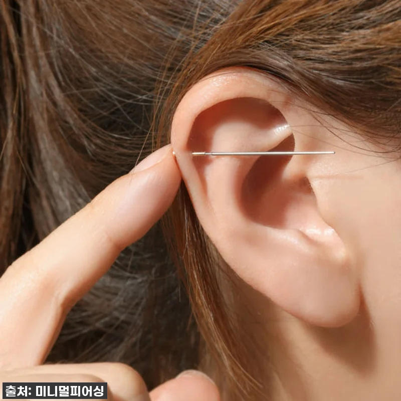 💖피어싱 덕후의 찐후기! 인터널 라블렛 착용, 이젠 눈 감고도 해요! (ft. 48% 할인 지금이 기회!)💖 16 💖피어싱 덕후의 찐후기! 인터널 라블 관련 이미지 5