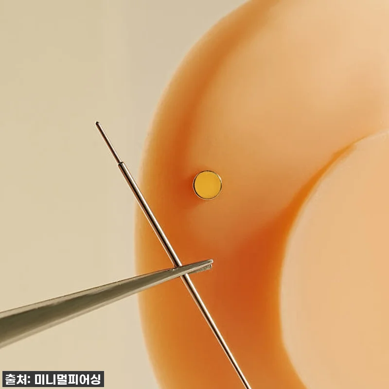 💖피어싱 덕후의 찐후기! 인터널 라블렛 착용, 이젠 눈 감고도 해요! (ft. 48% 할인 지금이 기회!)💖 20 💖피어싱 덕후의 찐후기! 인터널 라블 관련 이미지 9