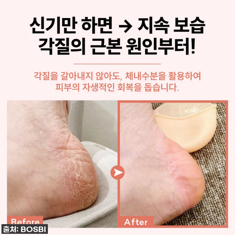 인생템 등극! 보스비 스킨힐캡 찐사용 관련 이미지 3