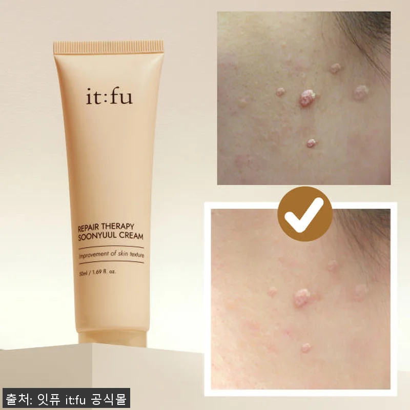 율무 나이아신아마이드 순율 크림 50 관련 이미지 7