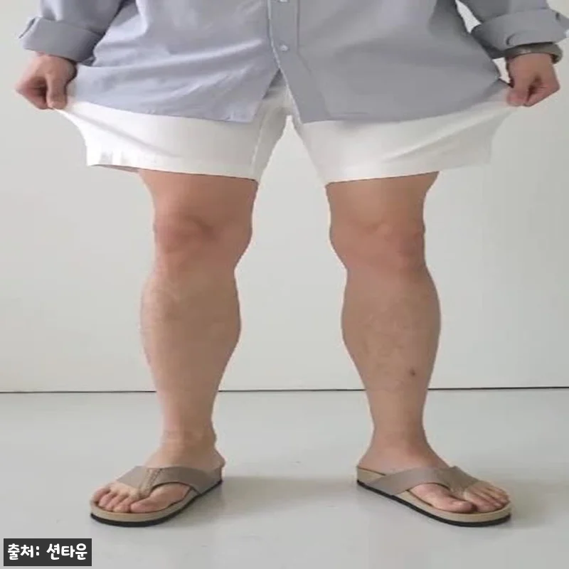 남자 빅사이즈 밴딩 스판 면 코튼 흰색 여름 반바지 슬랙스, 여름 데일리룩으로 눈여겨볼 이슈템 12 남자 빅사이즈 밴딩 스판 면 코튼 흰 관련 이미지 5